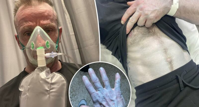 Man hospitalized after turning completely blue â leading to bizarre bedroom discovery
